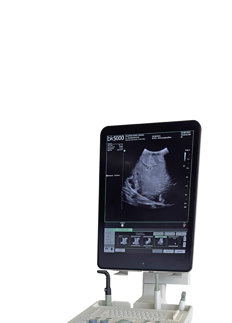 Intraoperative Ultrasound
